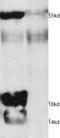 Pan Acetylated-Lysine  antibody, 251116, Abbiotec, Western Blot image 