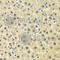 Sphingosine Kinase 1 antibody, A0139, ABclonal Technology, Immunohistochemistry paraffin image 