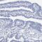 Myelin Oligodendrocyte Glycoprotein antibody, PA5-54531, Invitrogen Antibodies, Immunohistochemistry frozen image 