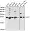 40S ribosomal protein S7 antibody, GTX33479, GeneTex, Western Blot image 
