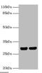 HLA class II histocompatibility antigen, DRB1-12 beta chain antibody, A50716-100, Epigentek, Western Blot image 