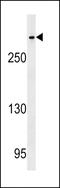 Centromere Protein E antibody, LS-C159333, Lifespan Biosciences, Western Blot image 