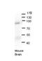 hOSC antibody, PA5-42069, Invitrogen Antibodies, Western Blot image 