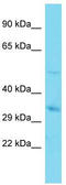 CXXC Finger Protein 5 antibody, TA344201, Origene, Western Blot image 
