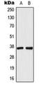 Aldo-keto reductase family 1 member C1 antibody, orb216087, Biorbyt, Western Blot image 