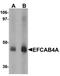 Calcium Release Activated Channel Regulator 2B antibody, orb75520, Biorbyt, Western Blot image 