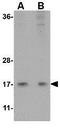 Histidine Triad Nucleotide Binding Protein 1 antibody, GTX17017, GeneTex, Western Blot image 