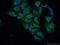 Synuclein Alpha antibody, 10842-1-AP, Proteintech Group, Immunofluorescence image 