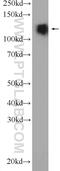 Proopiomelanocortin antibody, 25088-1-AP, Proteintech Group, Western Blot image 