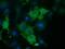 Coronin 1B antibody, GTX84676, GeneTex, Immunofluorescence image 