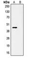 Non-structural protein V antibody, orb248963, Biorbyt, Western Blot image 