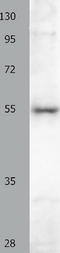 BAI1 Associated Protein 2 antibody, TA323918, Origene, Western Blot image 