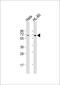 GPI mannosyltransferase 3 antibody, 60-888, ProSci, Western Blot image 