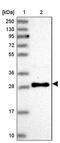 Vesicle transport protein USE1 antibody, PA5-61548, Invitrogen Antibodies, Western Blot image 