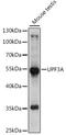 UPF3A Regulator Of Nonsense Mediated MRNA Decay antibody, A15893, ABclonal Technology, Western Blot image 