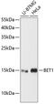 Bet1 Golgi Vesicular Membrane Trafficking Protein antibody, 14-775, ProSci, Western Blot image 