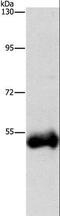 Dipeptidyl peptidase 1 antibody, LS-C403028, Lifespan Biosciences, Western Blot image 