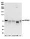 Myotubularin-related protein 2 antibody, A304-535A, Bethyl Labs, Western Blot image 