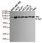 B-Raf Proto-Oncogene, Serine/Threonine Kinase antibody, TA346896, Origene, Western Blot image 