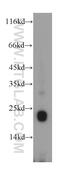 Somatotropin antibody, 17867-1-AP, Proteintech Group, Western Blot image 