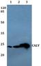 Calcyon Neuron Specific Vesicular Protein antibody, A08000, Boster Biological Technology, Western Blot image 