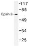 Epsin 2 antibody, AP01400PU-N, Origene, Western Blot image 