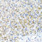 DNA repair protein RAD51 homolog 3 antibody, 22-588, ProSci, Immunohistochemistry paraffin image 