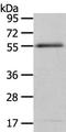 Ectonucleotide Pyrophosphatase/Phosphodiesterase 7 antibody, TA322001, Origene, Western Blot image 