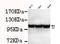 Hexokinase-2 antibody, LS-C178356, Lifespan Biosciences, Western Blot image 