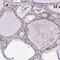 Nucleoporin 188 antibody, PA5-63984, Invitrogen Antibodies, Immunohistochemistry frozen image 