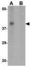Ribonuclease T2 antibody, GTX31475, GeneTex, Western Blot image 