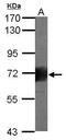 HMMR antibody, GTX100795, GeneTex, Western Blot image 