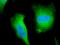 Pan-Calcineurin A antibody, orb107279, Biorbyt, Immunofluorescence image 