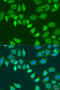 L-2-Hydroxyglutarate Dehydrogenase antibody, 15-919, ProSci, Immunofluorescence image 