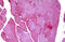 Glycogen Phosphorylase, Muscle Associated antibody, MBS245678, MyBioSource, Immunohistochemistry frozen image 