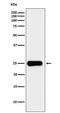 Prolactin-3D1 antibody, M05177-3, Boster Biological Technology, Western Blot image 