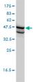 Small RNA Binding Exonuclease Protection Factor La antibody, H00006741-M01, Novus Biologicals, Western Blot image 