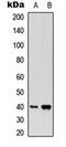 Prostaglandin D2 receptor antibody, orb315671, Biorbyt, Western Blot image 