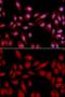 Proteasome Subunit Alpha 2 antibody, GTX54618, GeneTex, Immunocytochemistry image 