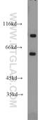 DnaJ Heat Shock Protein Family (Hsp40) Member C16 antibody, 17599-1-AP, Proteintech Group, Western Blot image 