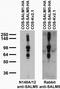 Leucine Rich Repeat And Fibronectin Type III Domain Containing 5 antibody, 73-192, Antibodies Incorporated, Western Blot image 