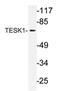 Testis Associated Actin Remodelling Kinase 1 antibody, AP21169PU-N, Origene, Western Blot image 