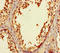 Zinc finger protein 230 antibody, orb26461, Biorbyt, Immunohistochemistry paraffin image 