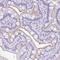Zinc Finger Protein 319 antibody, NBP2-47566, Novus Biologicals, Immunohistochemistry paraffin image 