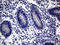  antibody, LS-C798281, Lifespan Biosciences, Immunohistochemistry paraffin image 