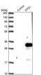 D-Aminoacyl-TRNA Deacylase 1 antibody, PA5-59376, Invitrogen Antibodies, Western Blot image 