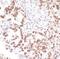 Bromodomain-containing protein 4 antibody, NBP2-76394, Novus Biologicals, Immunohistochemistry paraffin image 