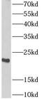 Actin Related Protein 2/3 Complex Subunit 4 antibody, FNab00603, FineTest, Western Blot image 