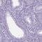 SHC Binding And Spindle Associated 1 Like antibody, HPA064821, Atlas Antibodies, Immunohistochemistry paraffin image 