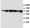 Abl Interactor 1 antibody, PA5-78705, Invitrogen Antibodies, Western Blot image 